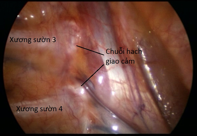 giaiphaulongnguc2 jpg gif