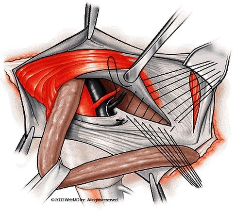 27 07 custom size 484 436