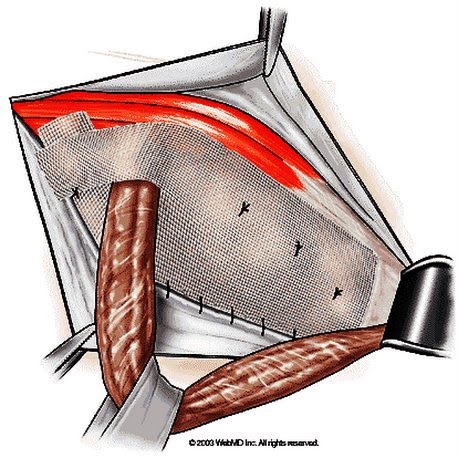 27 08 custom size 458 458