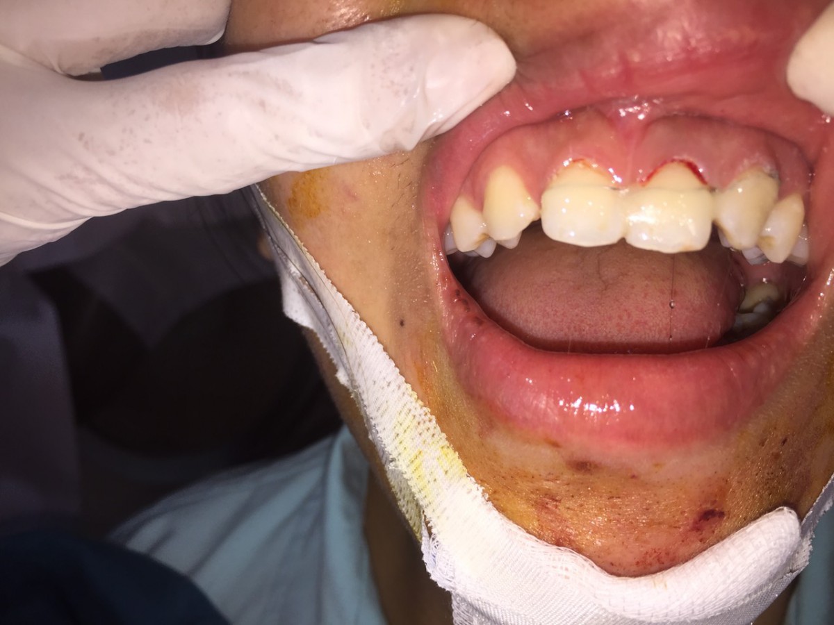 image 20200415091711 6