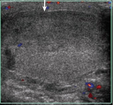 image 20200824144655 6