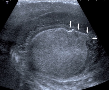 image 20200824144655 7