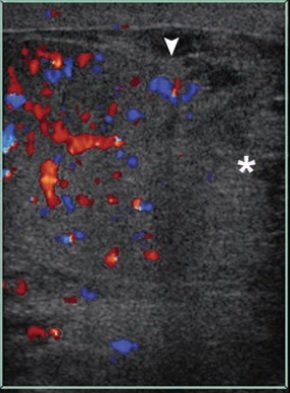 image 20200824144655 8