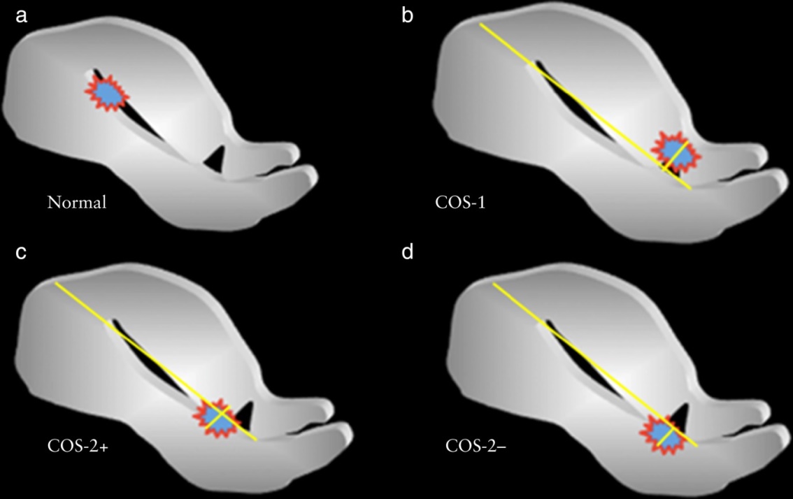 Đánh giá kết quả điều trị bệnh lý thai bám sẹo mổ lấy thai tại Bệnh viện Đa khoa tỉnh Quảng Trị