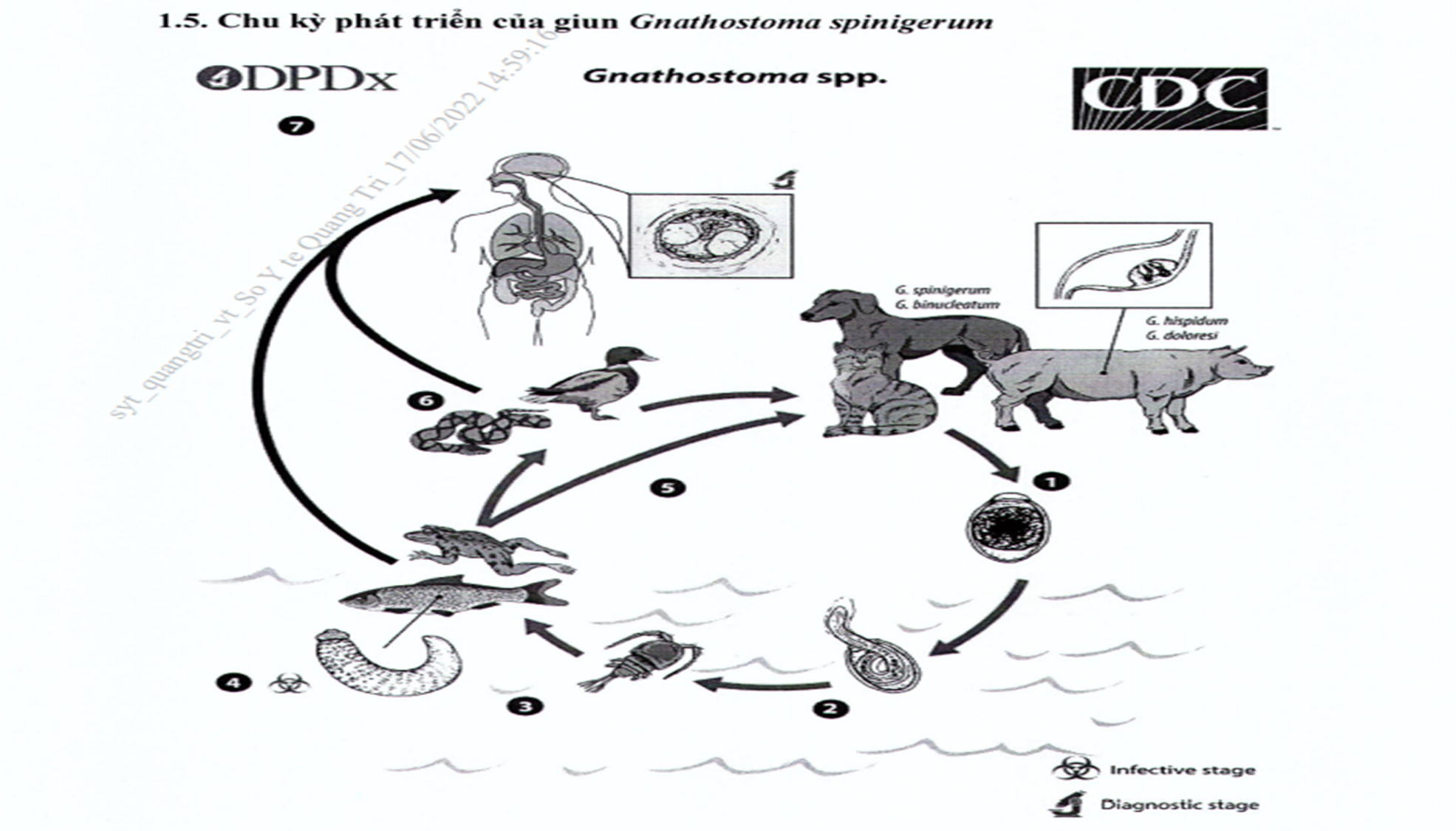 BỆNH ẤU TRÙNG GIUN ĐẦU GAI