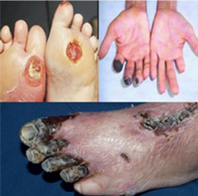 Cập nhật chẩn đoán và điều trị đái tháo đường ở người lớn tuổi