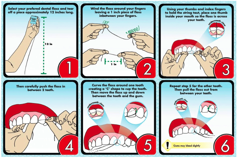 Sử dụng chỉ nha khoa nhẹ nhàng và đúng cách để tránh làm tổn thương nướu