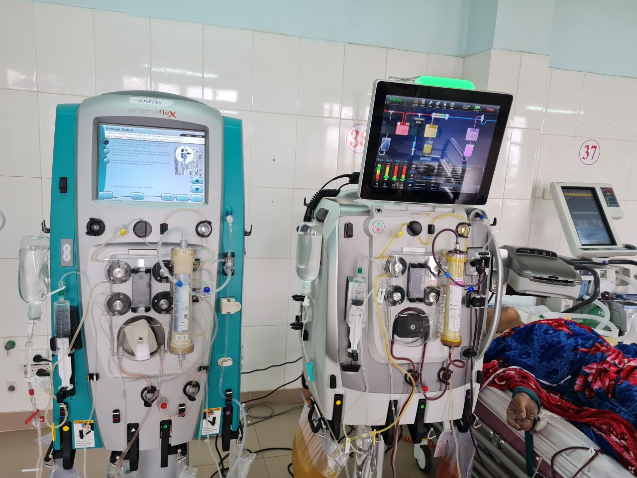 Kết hợp thay huyết tương với lọc máu liên tục ở bệnh nhân sốc nhiễm khuẩn có suy gan cấp.