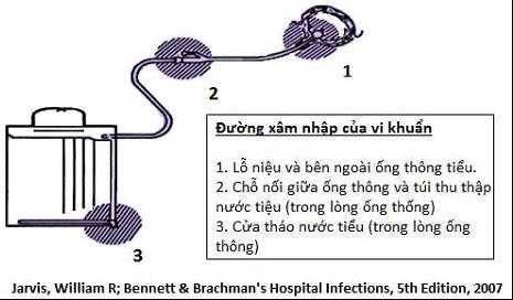  Các yếu tố nguy cơ gây nhiễm khuẩn tiết niệu