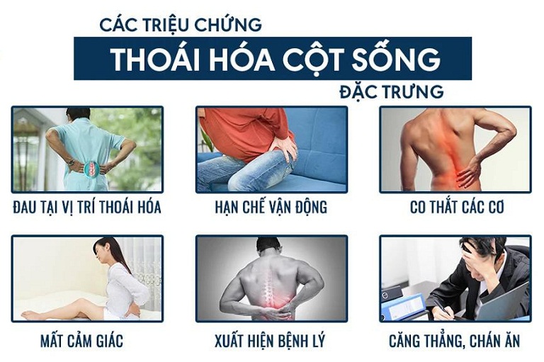 Bệnh thoái hóa cột sống thắt lưng