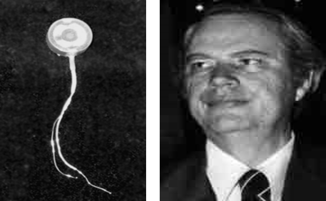 Hình. Ốc tai điện tử đơn kênh đầu tiên do giáo sư W. House chế tạo