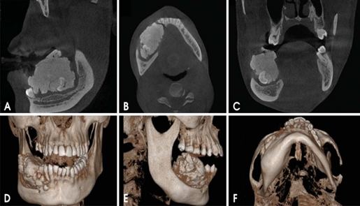 Cone Beam Ct & Những Ứng Dụng Trong Chuyên Ngành RHM