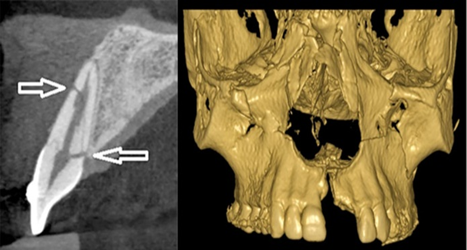 Cone Beam Ct & Những Ứng Dụng Trong Chuyên Ngành RHM