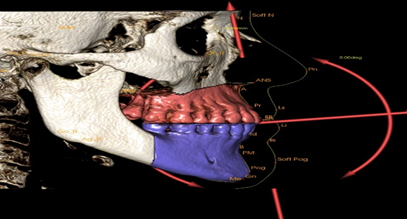 Cone Beam Ct & Những Ứng Dụng Trong Chuyên Ngành RHM