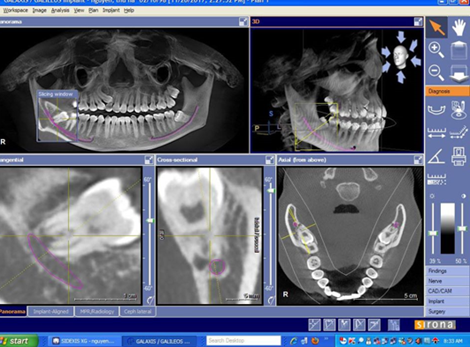 Cone Beam Ct & Những Ứng Dụng Trong Chuyên Ngành RHM