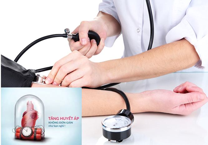 Cảnh báo đột tử do xuất huyết não