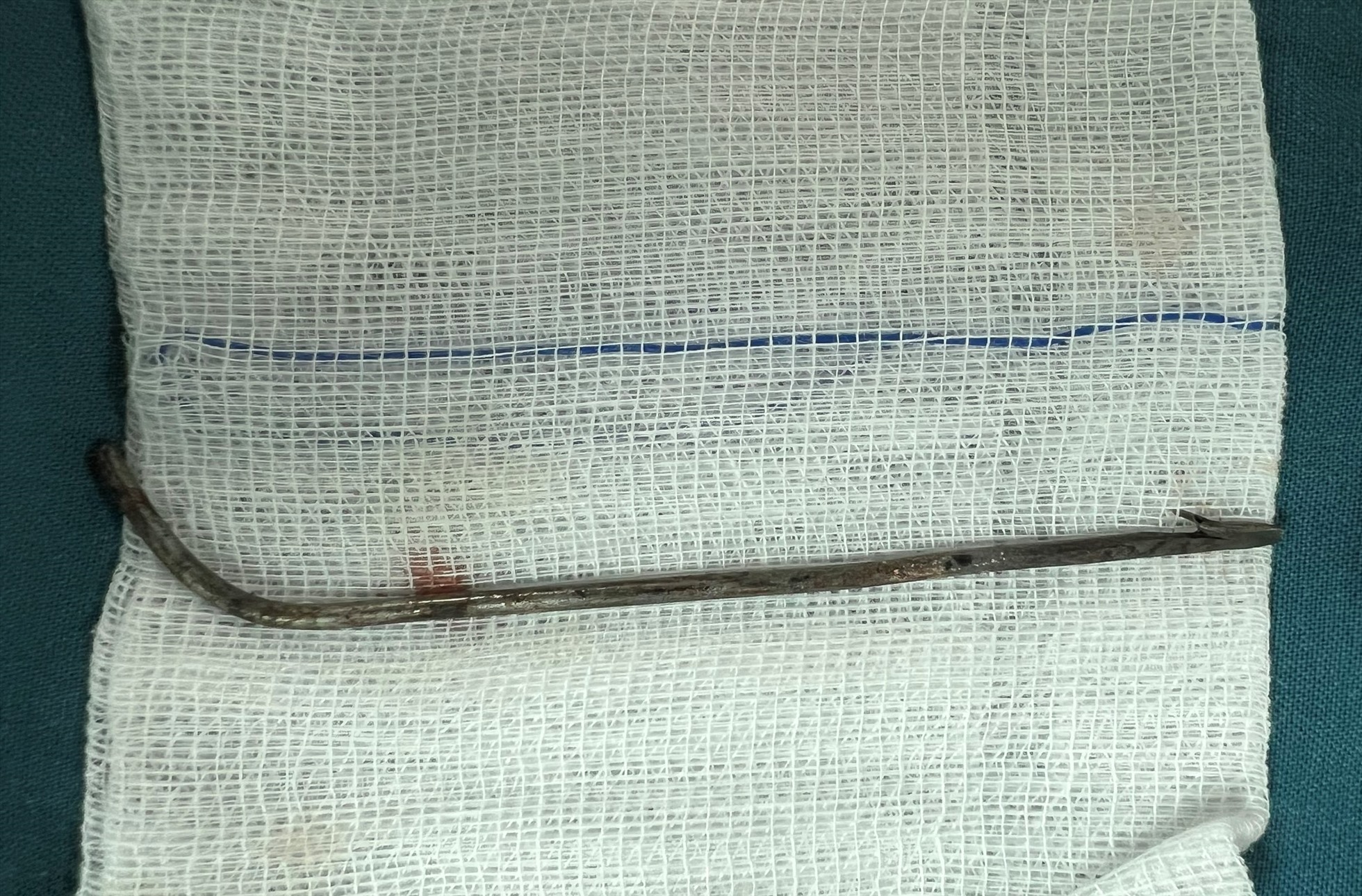 Phần mũi tên dài 7cm xuyên vào người bệnh nhân được lấy ra ngoài. Ảnh: A.Minh.