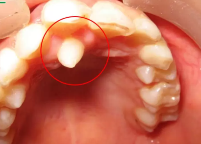 image 20231218155055 1