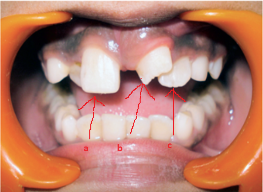 image 20231218155055 15 533x390