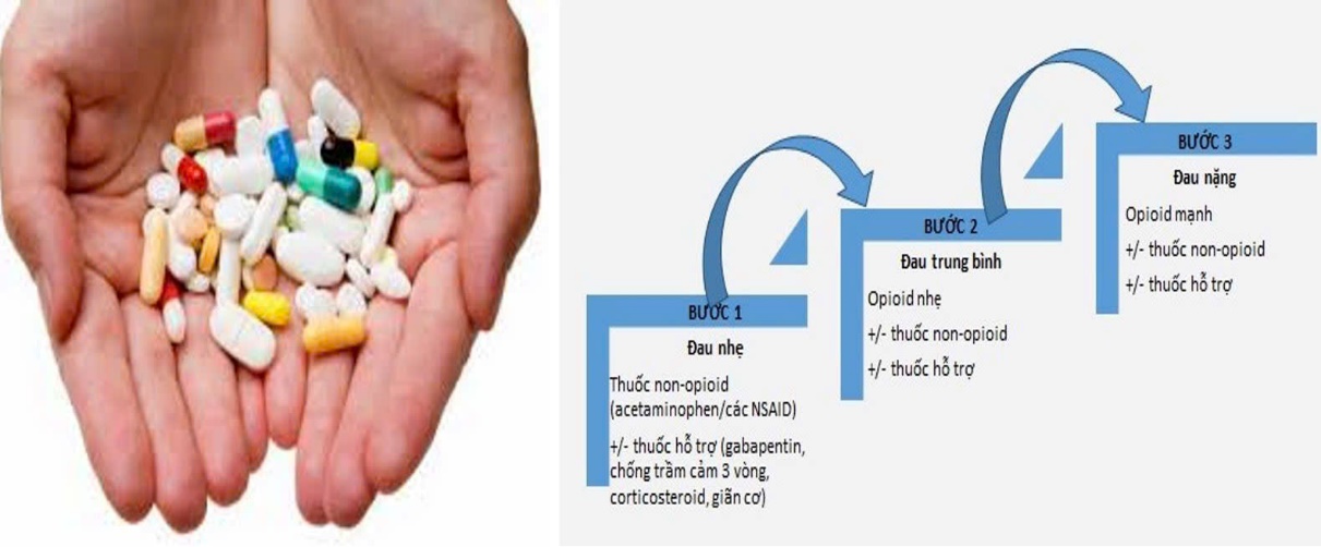 Bậc thang 3 bước điều trị giảm đau