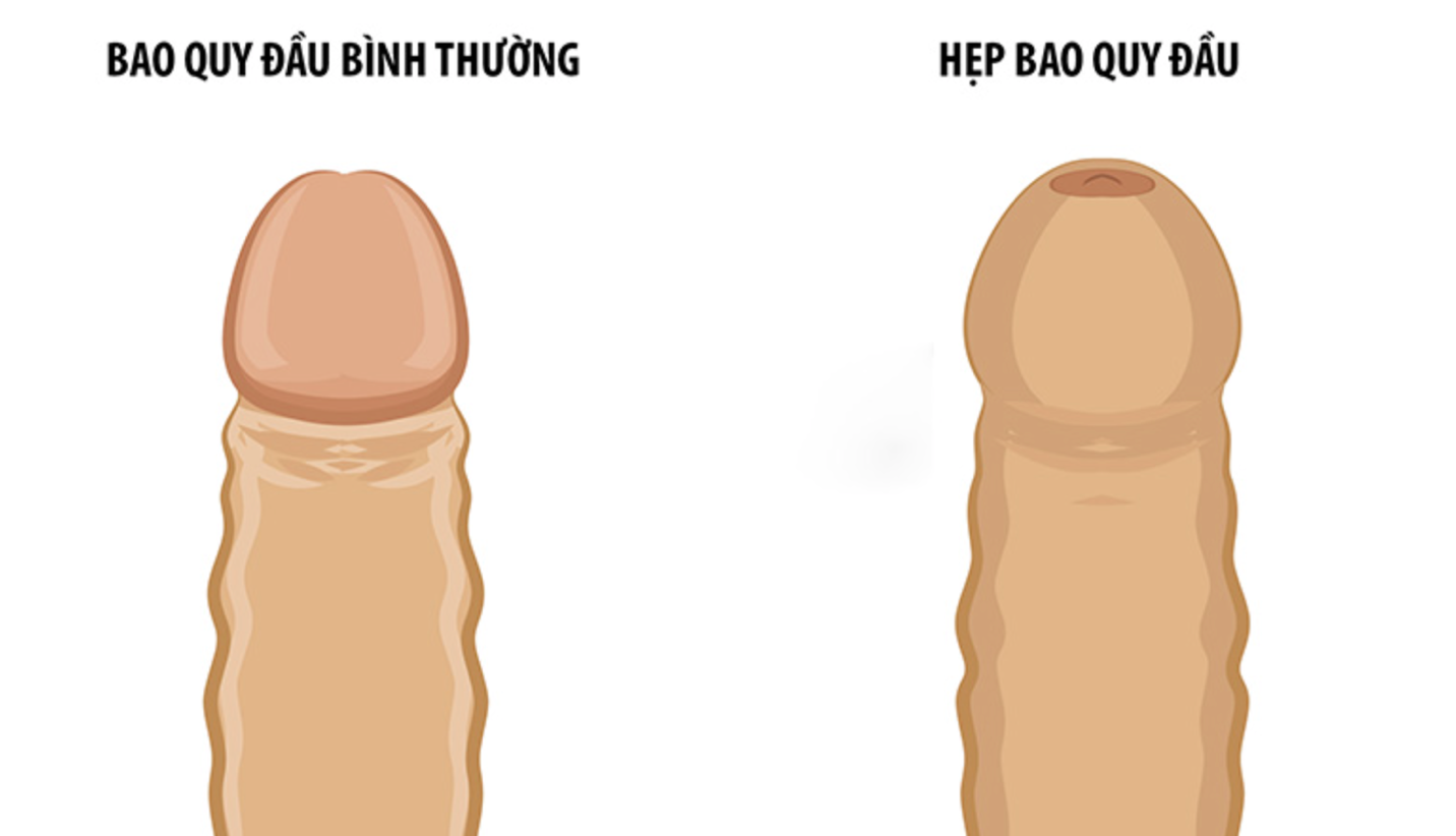 (Ảnh minh họa)