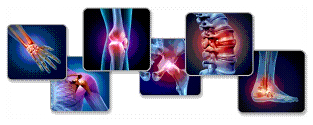 Hình ảnh minh họa