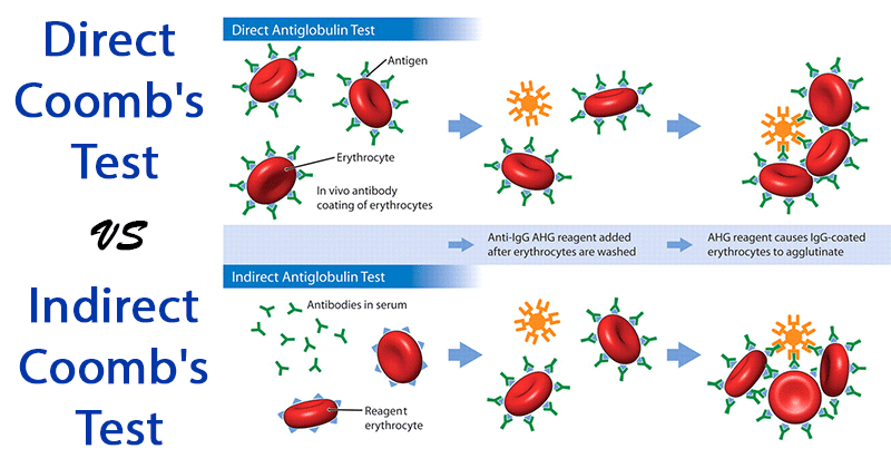 Xét nghiệm Coombs trực tiếp và gián tiếp